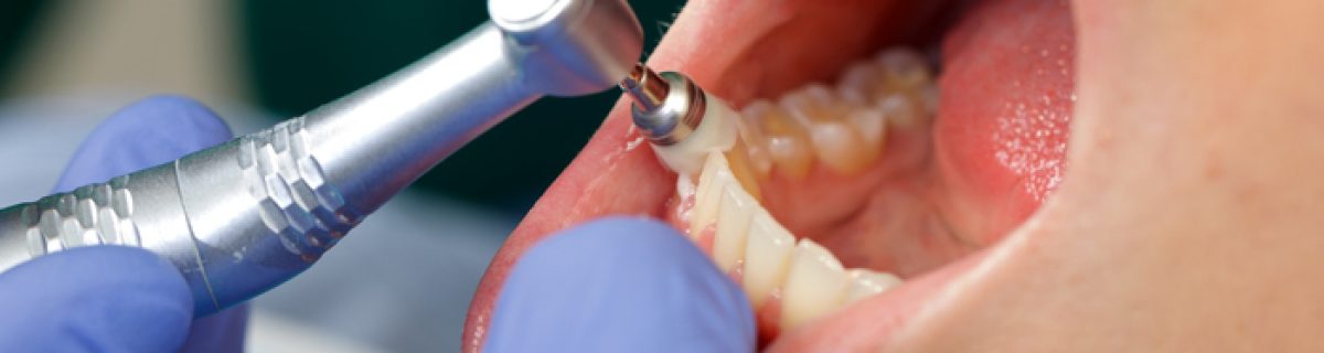 Close up of a professional dental brushing at the clinic